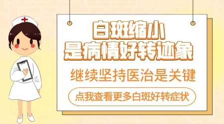 白癜风光疗仪使用的时间是多久