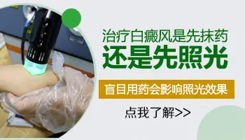 308光疗仪不抹药可以照吗