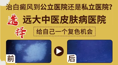 中医治疗白癜风有哪些方法