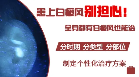 身上白斑扩散至全身怎么治