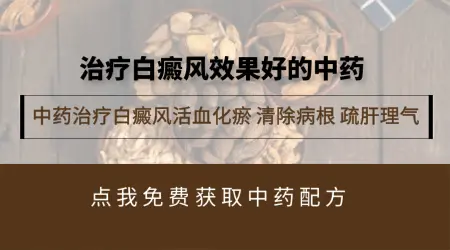 中药治白癜风的药方是什么