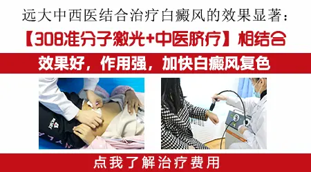 白斑病应该怎么治疗