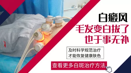 白癜风汗毛变白能不能治好