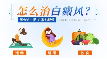 治好白癜风的方案都有哪些