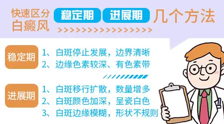 白癜风初期应该如何治疗