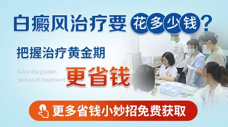 手脚白癜风治好花多少钱