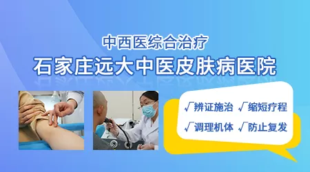 白癜风更快的治疗方法是什么