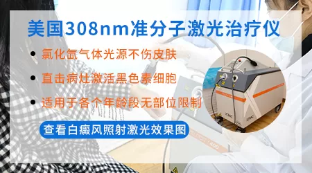 白癜风308激光治疗效果好吗