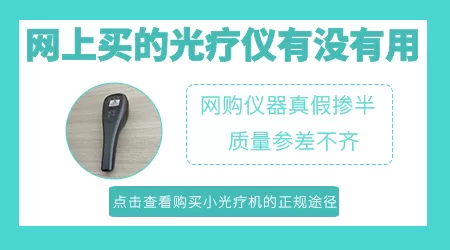 淘宝上买的308光照仪能治白癜风吗