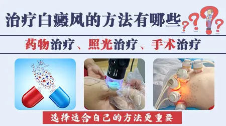 治疗白癜风的新方法