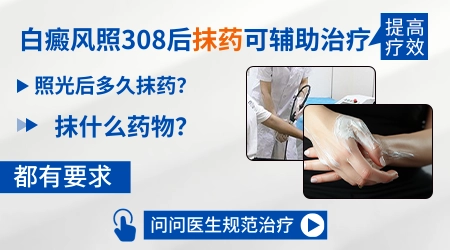 白癜风用什么药膏治疗最好