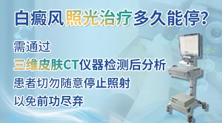 巴掌大白癜风照美国308光大概多少钱