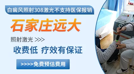 巴掌大白癜风照美国308光大概多少钱