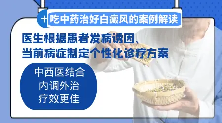 白癜风中药调理比西药治疗好不好