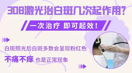 黑色素减退白斑能不能治好