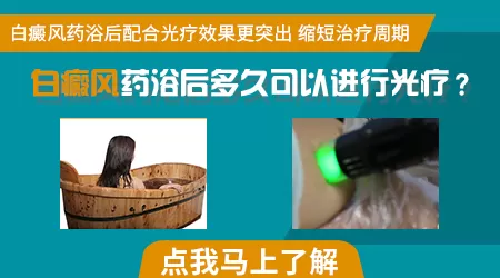 窄谱UVB治疗白斑需要多少次才能见效