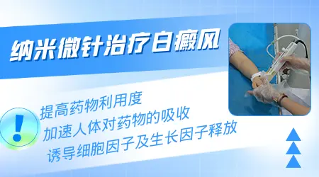 白斑微针可以激活黑色素吗