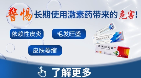 白癜风早期用什么药最有效