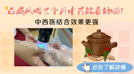 中医中药治疗白癜风的疗程通常是多久