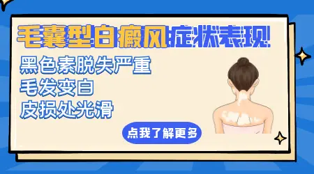 光疗对毛囊型白癜风有效吗