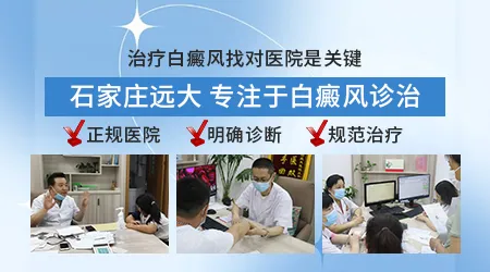 光疗治疗儿童白癜风安全吗