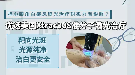 眼周白斑能用308激光照射吗