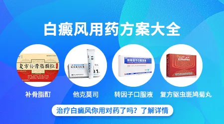 有没有特效药能根治白癜风