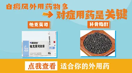 治疗白癜风最好的外用药膏是什么
