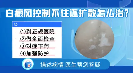 白癜风治疗过程中还扩大是正常现象吗