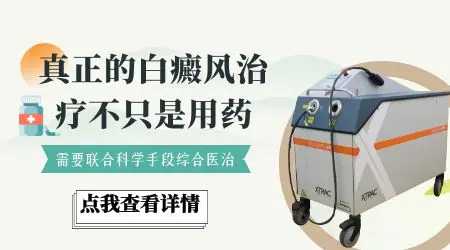 白癜风早期凃他克莫司软膏能好吗