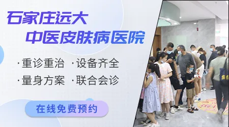 民间偏方会加重白癜风病情吗