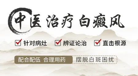 中西医结合治疗白癜风是怎么治