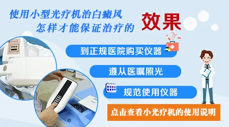 网上家用光疗仪照白斑有没有效果
