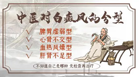 中医治疗白癜风效果怎么样