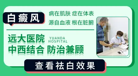 身上白斑用中药能治好吗