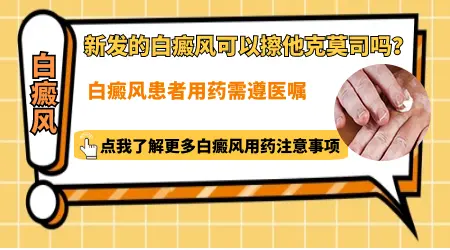白癜风早期用他克莫司就能好吗