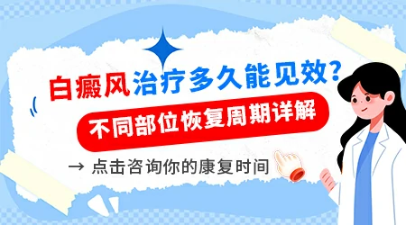 白斑治疗周期一般多久