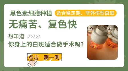 白癜风做黑色素细胞种植术靠谱吗