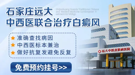 中西医结合治疗白癜风是怎么治