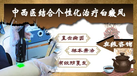 中西医结合治疗白癜风是怎么治