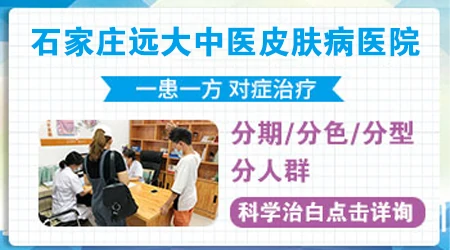 不同年龄段的孩子白癜风治疗方法有区别吗