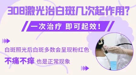 308准分子激光照白癜风的恢复率是多少