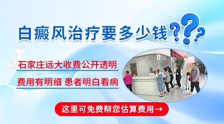 治疗白癜风大概需要花多少钱