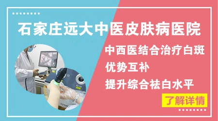 中西医结合治疗白癜风效果会不会更好