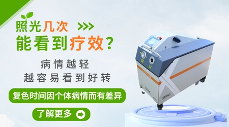 白癜风做光疗要坚持多久才能看到效果