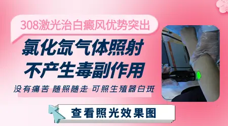 白斑长在隐私部位该怎么治疗