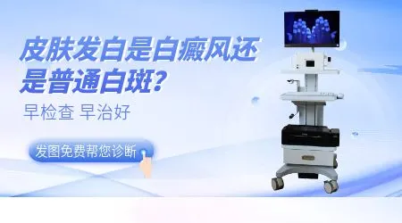 十几岁女孩皮肤出现白斑怎么治