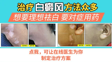 308激光治疗白癜风和黑色素种植哪个好