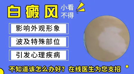 女性额头出现白色斑块是怎么回事