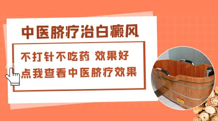 311窄谱UVB光疗适合大面积白斑吗
